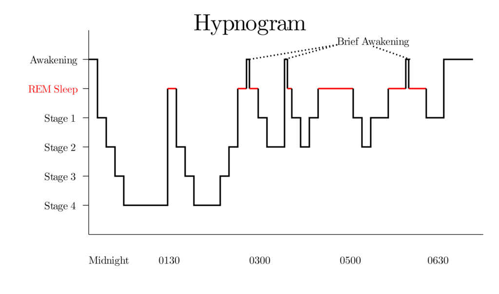 https://upload.wikimedia.org/wikipedia/commons/thumb/3/3e/Sleep_Hypnogram.svg/2000px-Sleep_Hypnogram.svg.png