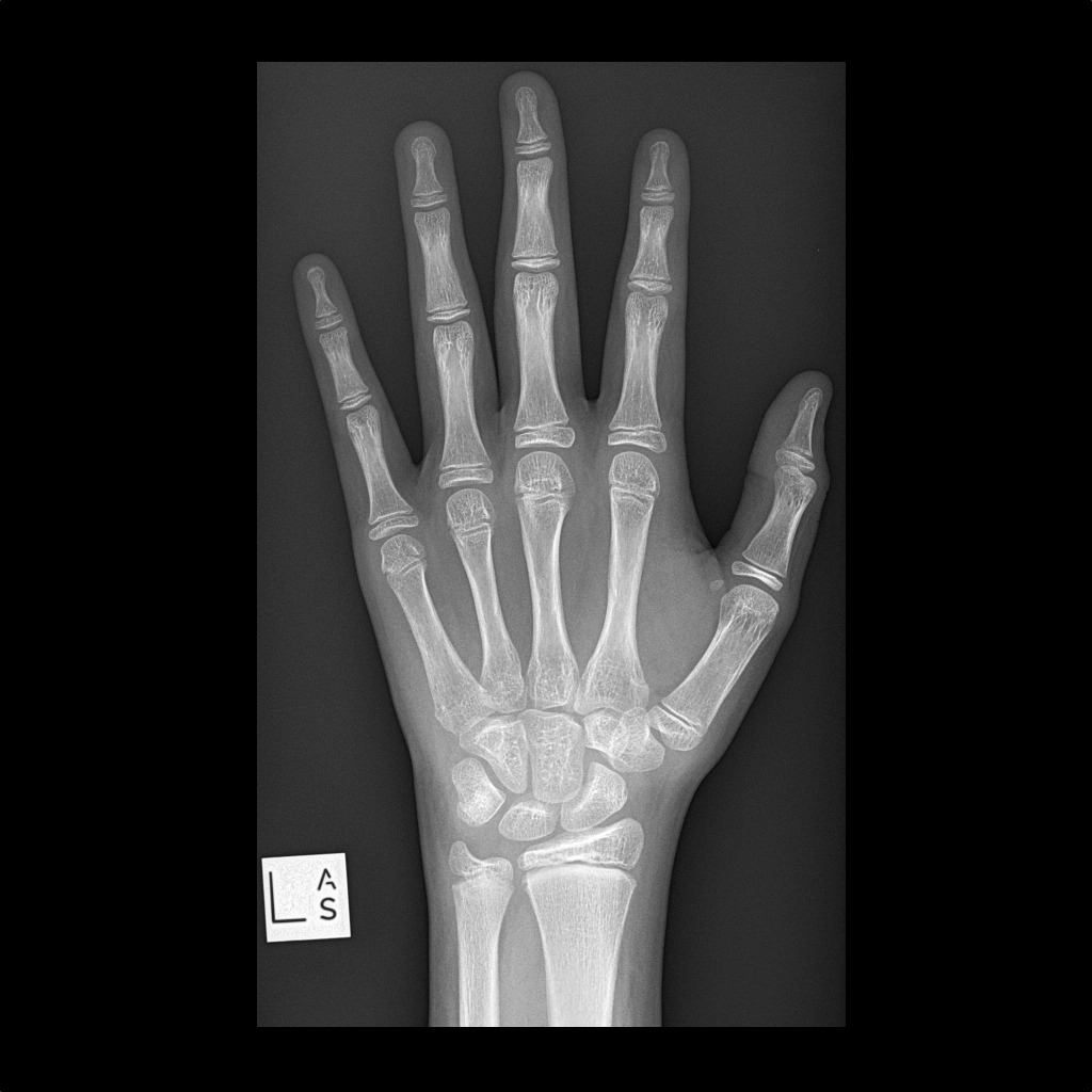 Wrist xrays