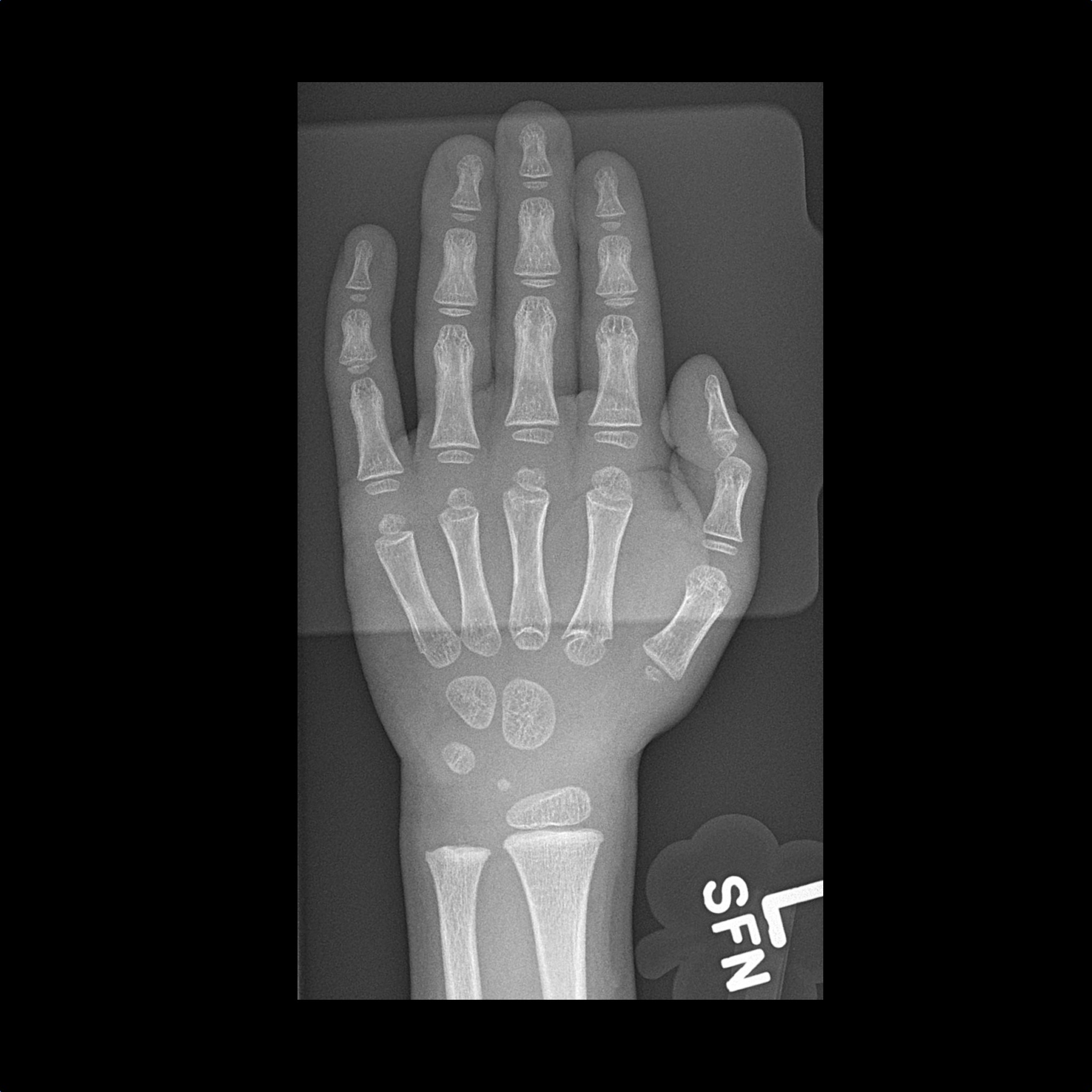 Wrist x rays