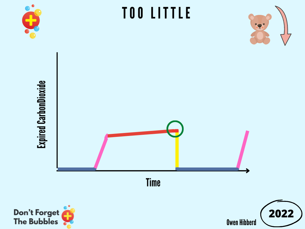 Too little ventilation can lead to a diminished wavefrom